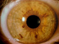 iris1