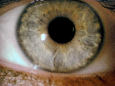 iris2